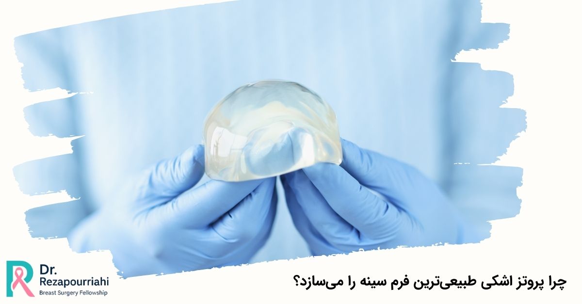 چرا پروتز اشکی طبیعیترین فرم سینه را میسازد؟
