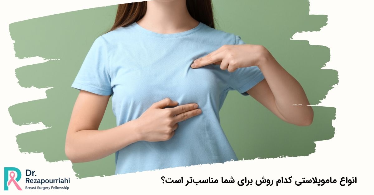 انواع ماموپلاستی کدام روش برای شما مناسبتر است؟