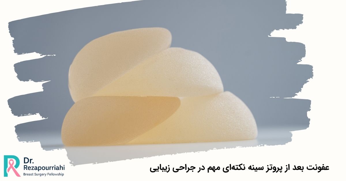 عفونت بعد از پروتز سینه نکتهای مهم در جراحی زیبایی