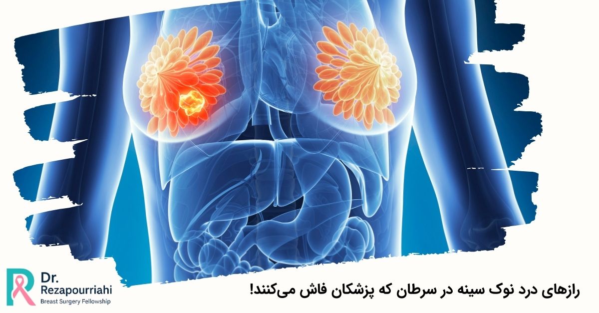 رازهای درد نوک سینه در سرطان که پزشکان فاش میکنند!