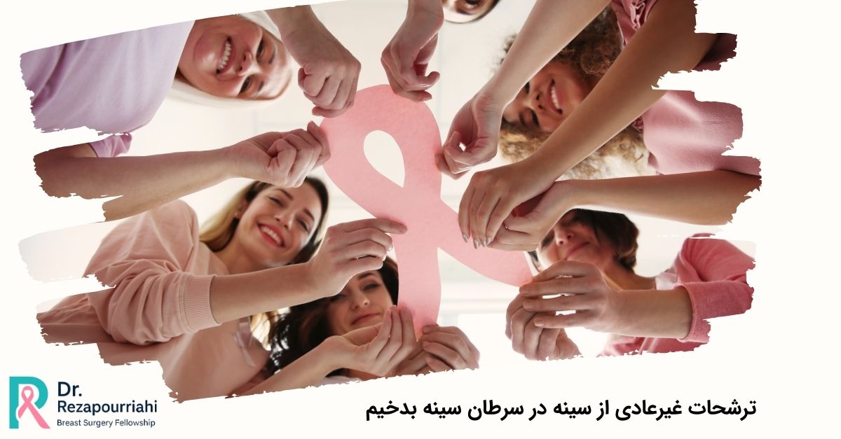 ترشحات غیرعادی از سینه در سرطان سینه بدخیم