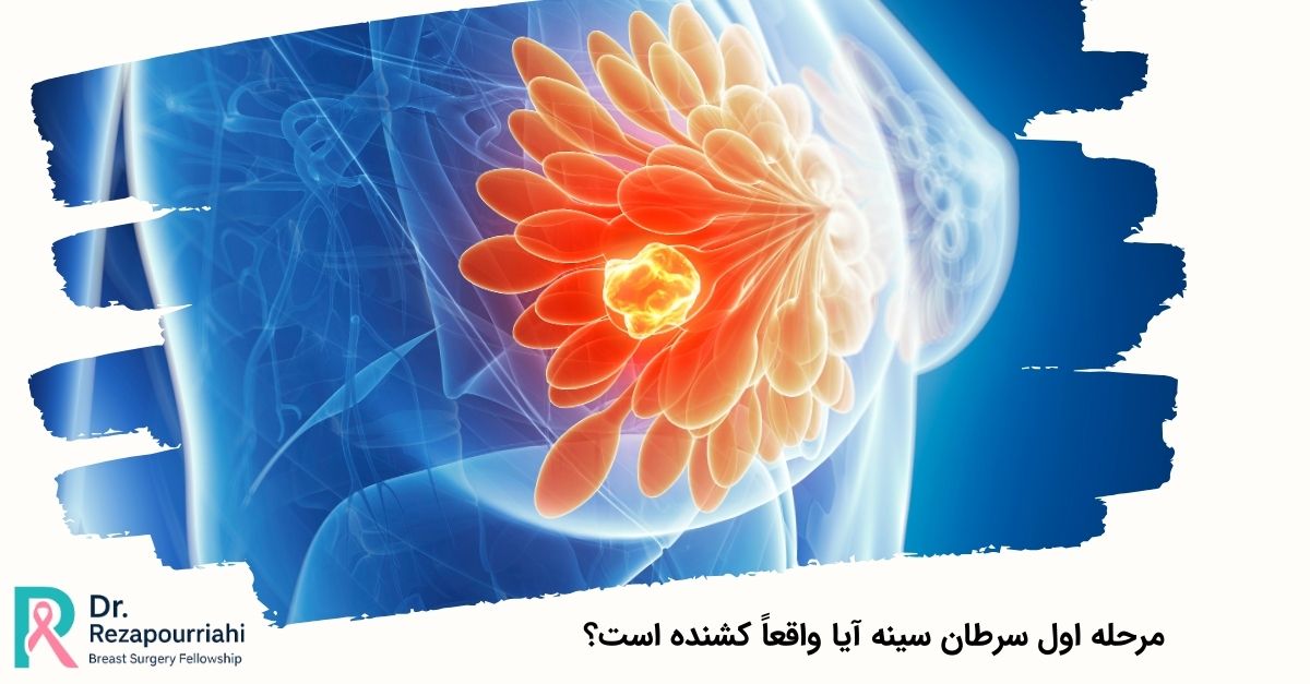 مرحله اول سرطان سینه آیا واقعاً کشنده است؟