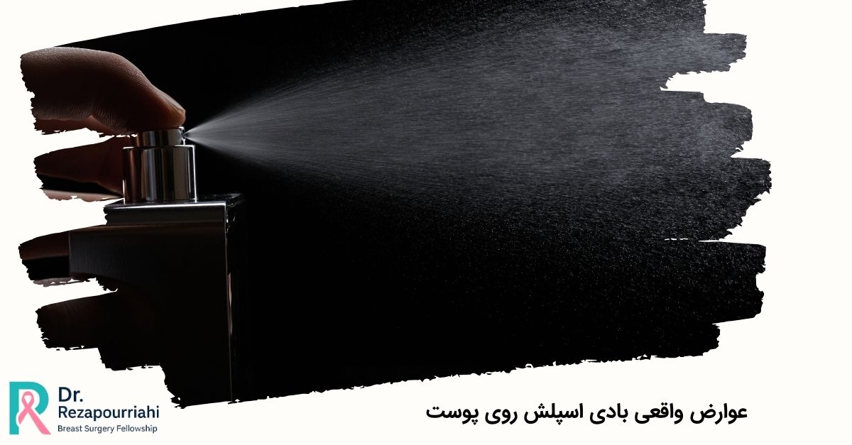 عوارض واقعی بادی اسپلش روی پوست