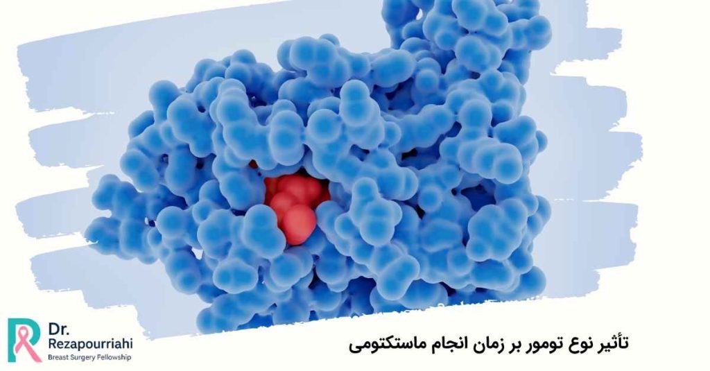 تأثیر نوع تومور بر زمان انجام ماستکتومی