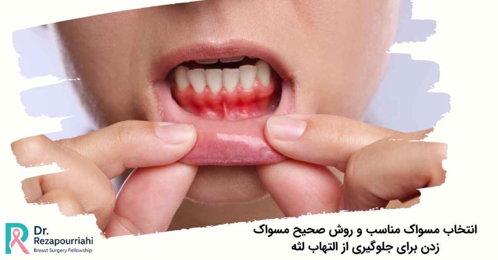 جلوگیری از التهاب لثه